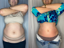 Load image into Gallery viewer, MOST POPULAR 12‑Pass — dramatic results, zero downtime.