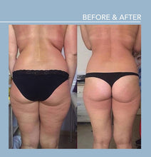 Load image into Gallery viewer, MOST POPULAR 12‑Pass — dramatic results, zero downtime.