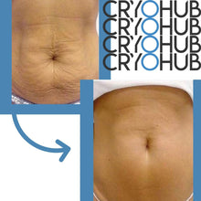 Load image into Gallery viewer, Intro Treatment