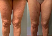 Load image into Gallery viewer, Intro Treatment