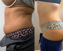 Load image into Gallery viewer, Intro Treatment