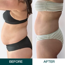 Load image into Gallery viewer, Mommy Makeover #1
