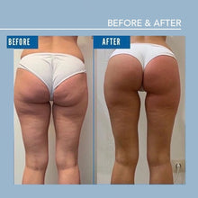 Load image into Gallery viewer, Smooth and Shape: Endospheres Therapy Intro Treatment
