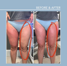 Load image into Gallery viewer, Smooth and Shape: Endospheres Therapy Intro Treatment

