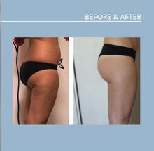 Load image into Gallery viewer, Smooth and Shape: Endospheres Therapy Intro Treatment
