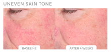 Load image into Gallery viewer, Cryohub | Medical Grade Skin Care | Age Reversal Kit

