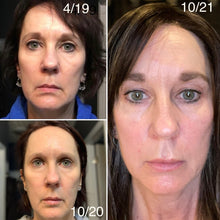 Load image into Gallery viewer, Anti-Aging Cryofacial Package of 4
